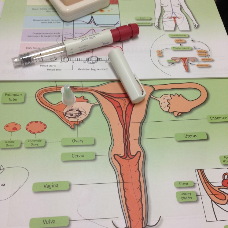 IVF Proceedure and Diagrams